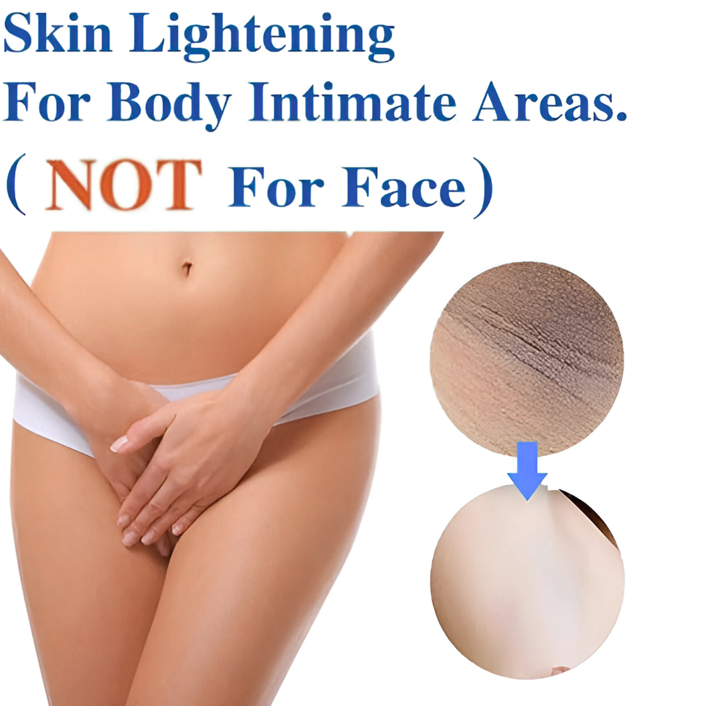 Whitening Cream for Intimate Area, Private Parts, Underarm, Knees, Elbows, Inner Thigh, Bikini Areas