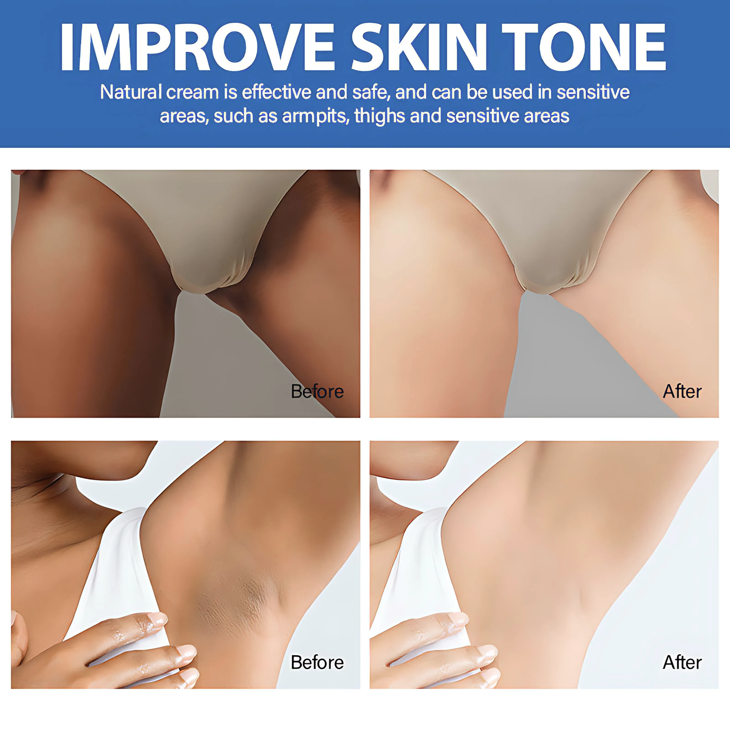 Whitening Cream for Intimate Area, Private Parts, Underarm, Knees, Elbows, Inner Thigh, Bikini Areas