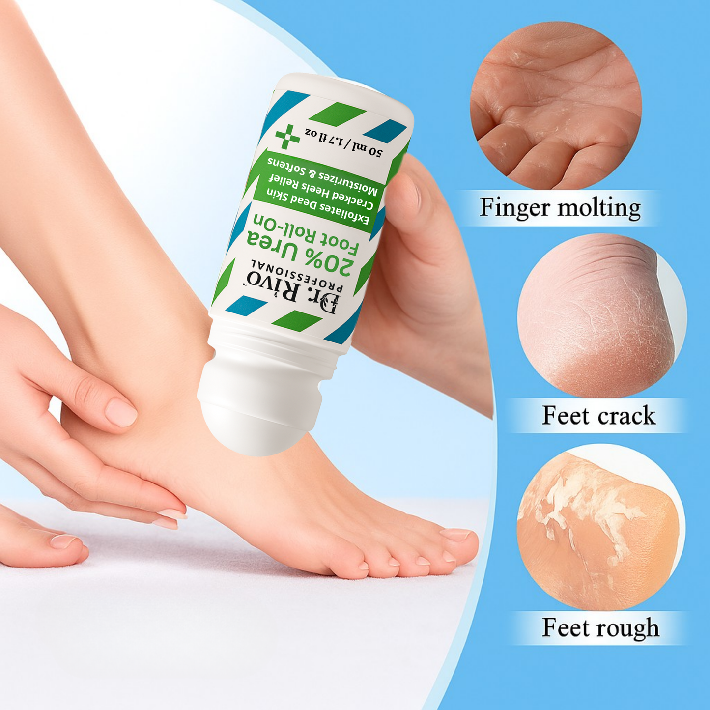 20% Urea Foot Roll-On | For Dry & Cracked Heels (50 ml, Set of 1)