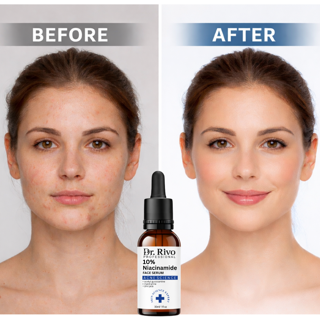 Niacinamide 10% Face Serum
