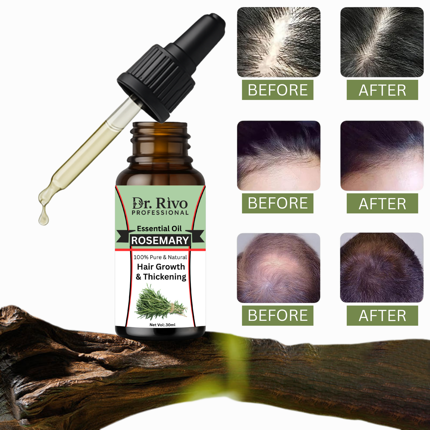 100% Pure & Natural Rosemary Essential Oil, Hair Growth, Skin Care, Aromatherapy (30 ml)