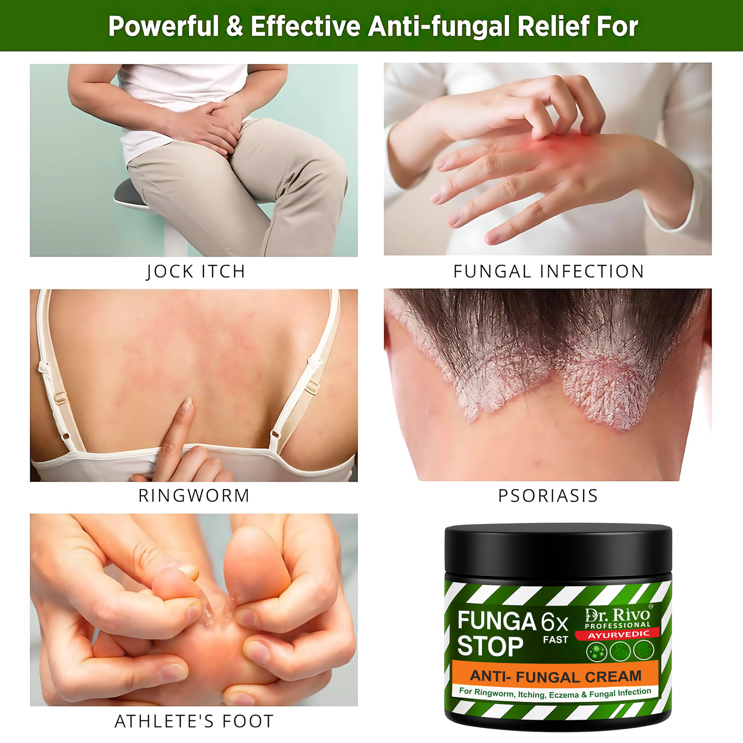 Anti fungal Creamction