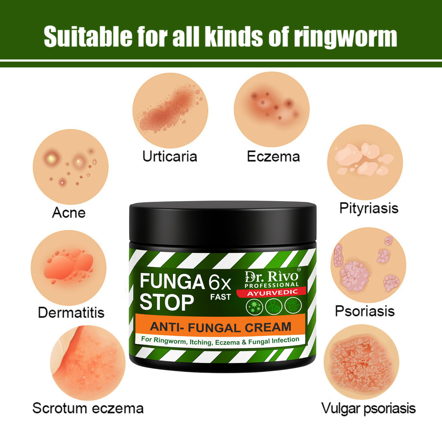 Anti fungal Creamction