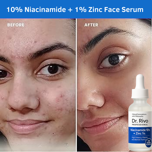 10% Niacinamide + 1% Zinc Face Serum | Powerful Anti-Acne & Glow Formula | Clears Blemishes, Controls Oil | Visible Results