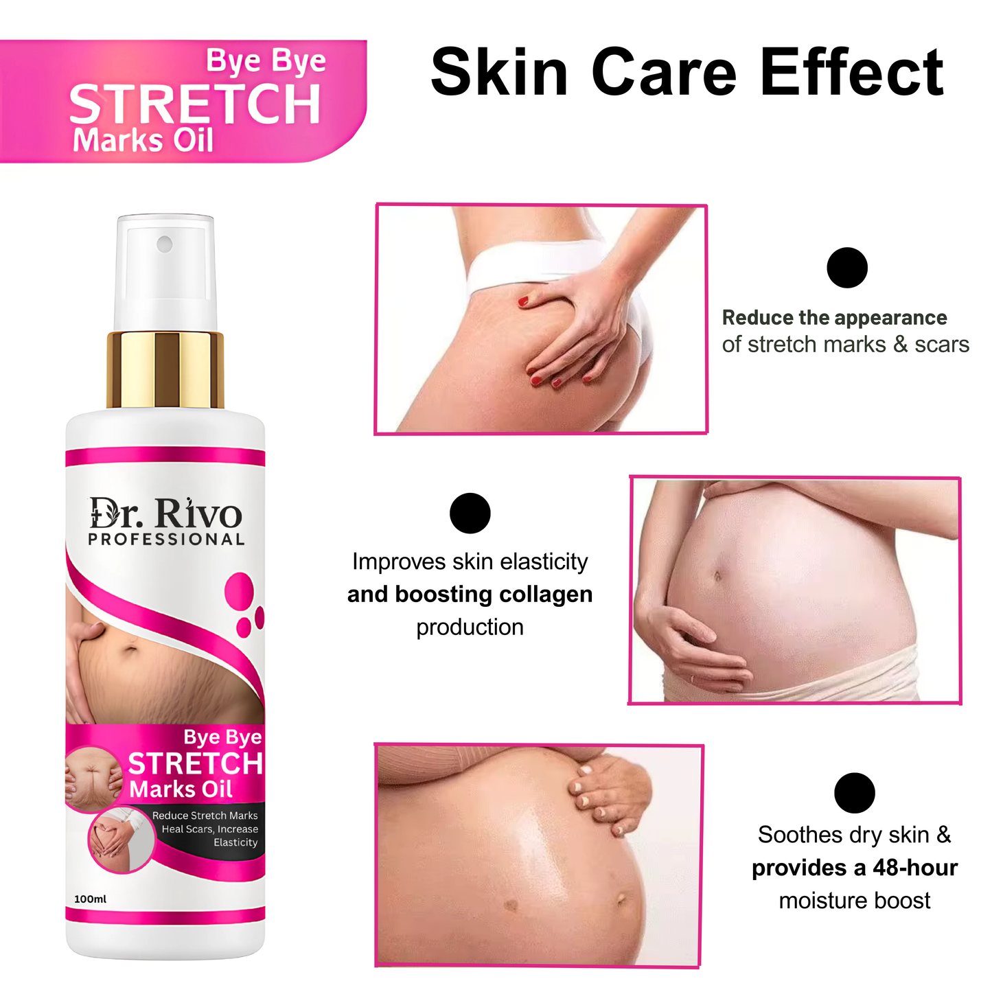 Dr.Rivo Professional present Repair Stretch Marks Removal-Natural Heal Pregnancy Breast,Hip,Legs,Marks oil 100 ml pack of 1