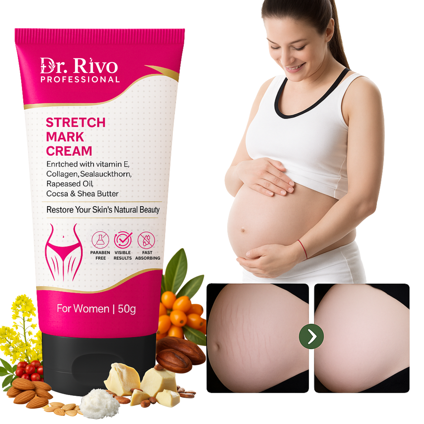 Stretch Marks Removal Cream in During After Pregnancy Delivery  (50 g)