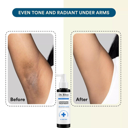 5% Glycolic Acid Under Arm Treatment