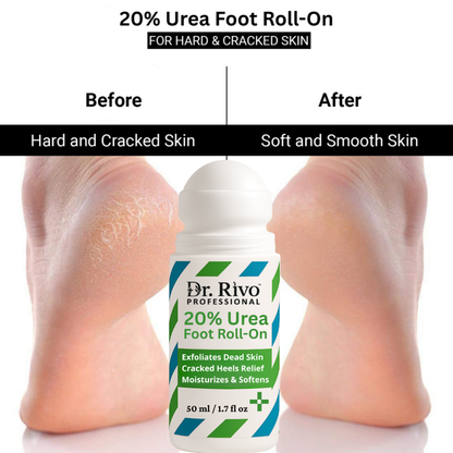 20% Urea Foot Roll-On | For Dry & Cracked Heels  (50 ml, Set of 1)