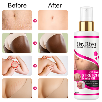 Dr.Rivo Professional present Repair Stretch Marks Removal-Natural Heal Pregnancy Breast,Hip,Legs,Marks oil 100 ml pack of 1