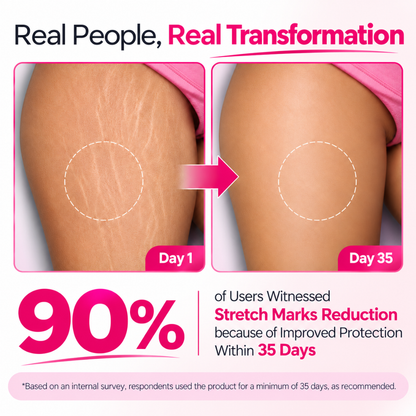Stretch Mark Cream