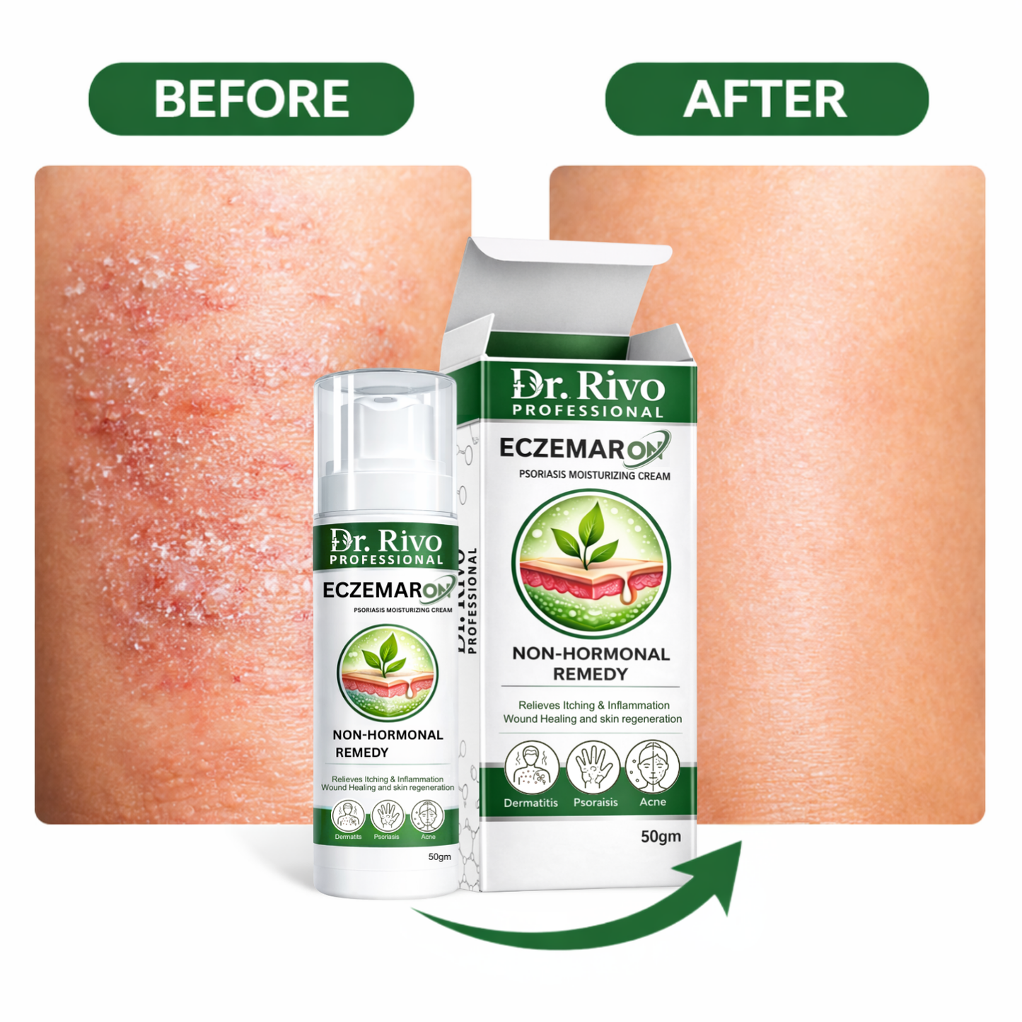 Skin Comfort Cream