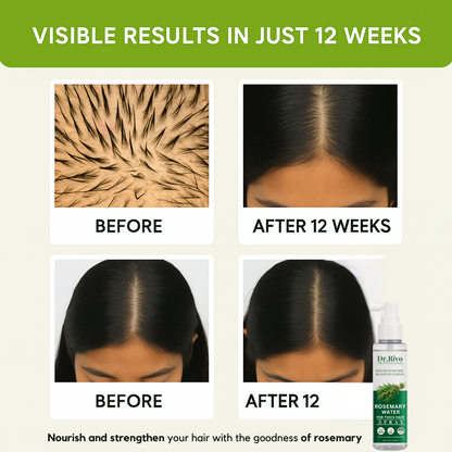 Rosemary Water For Hair Growth & Hair Repair for hair spray men & women  (100 ml)