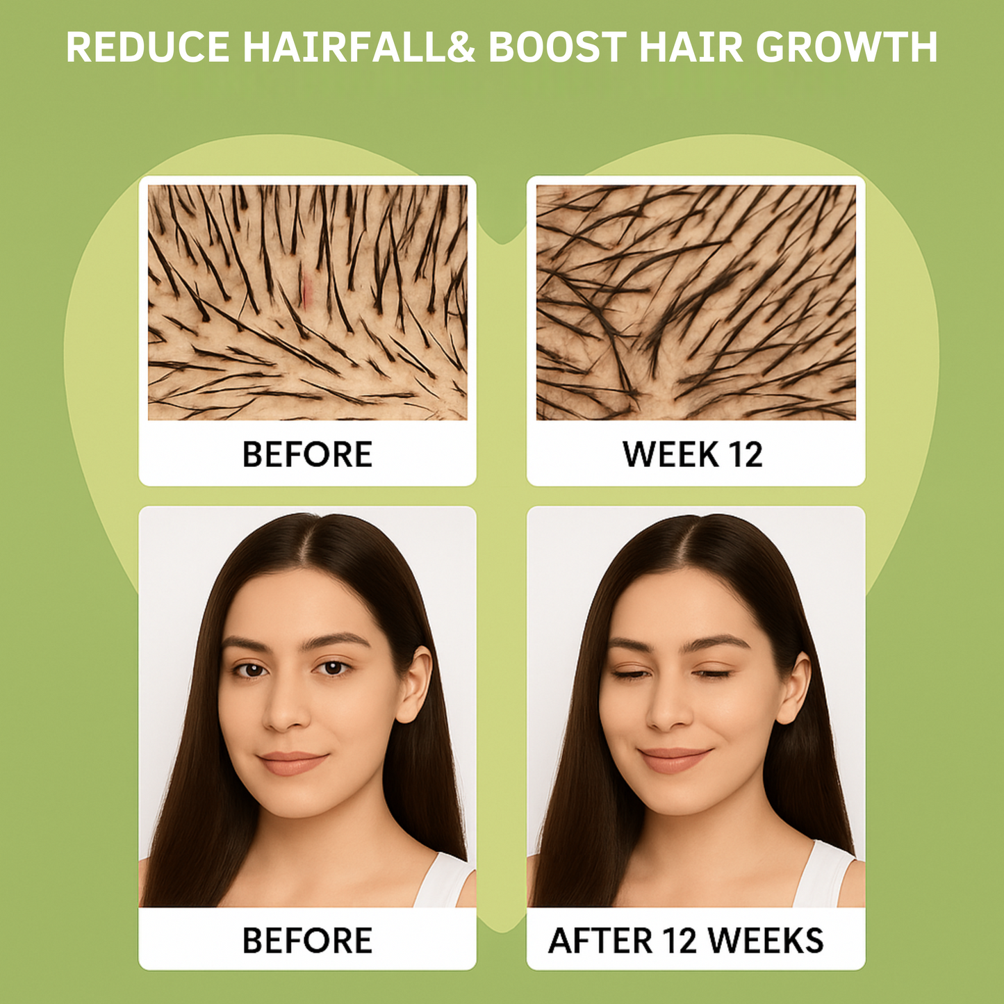 Hair Growth Serum Rosemary & Avocado | Reduces Hairfall & Boosts Hair Growth  (50 ml)