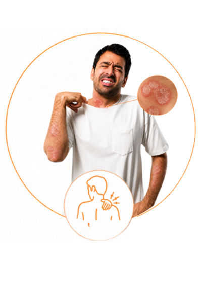 Skin Relief