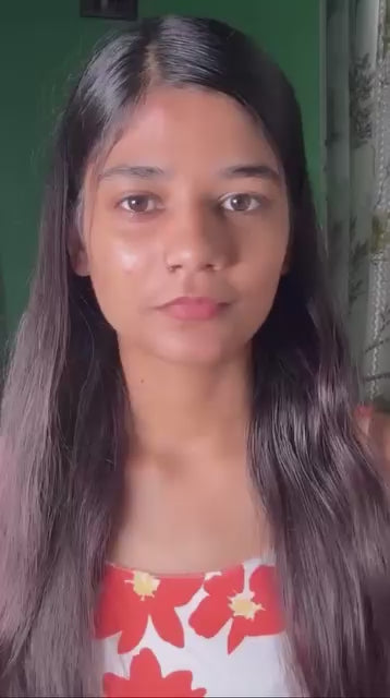 Stretch Marks Removal Cream in During After Pregnancy Delivery  (50 g)